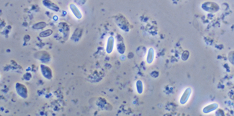Parasites